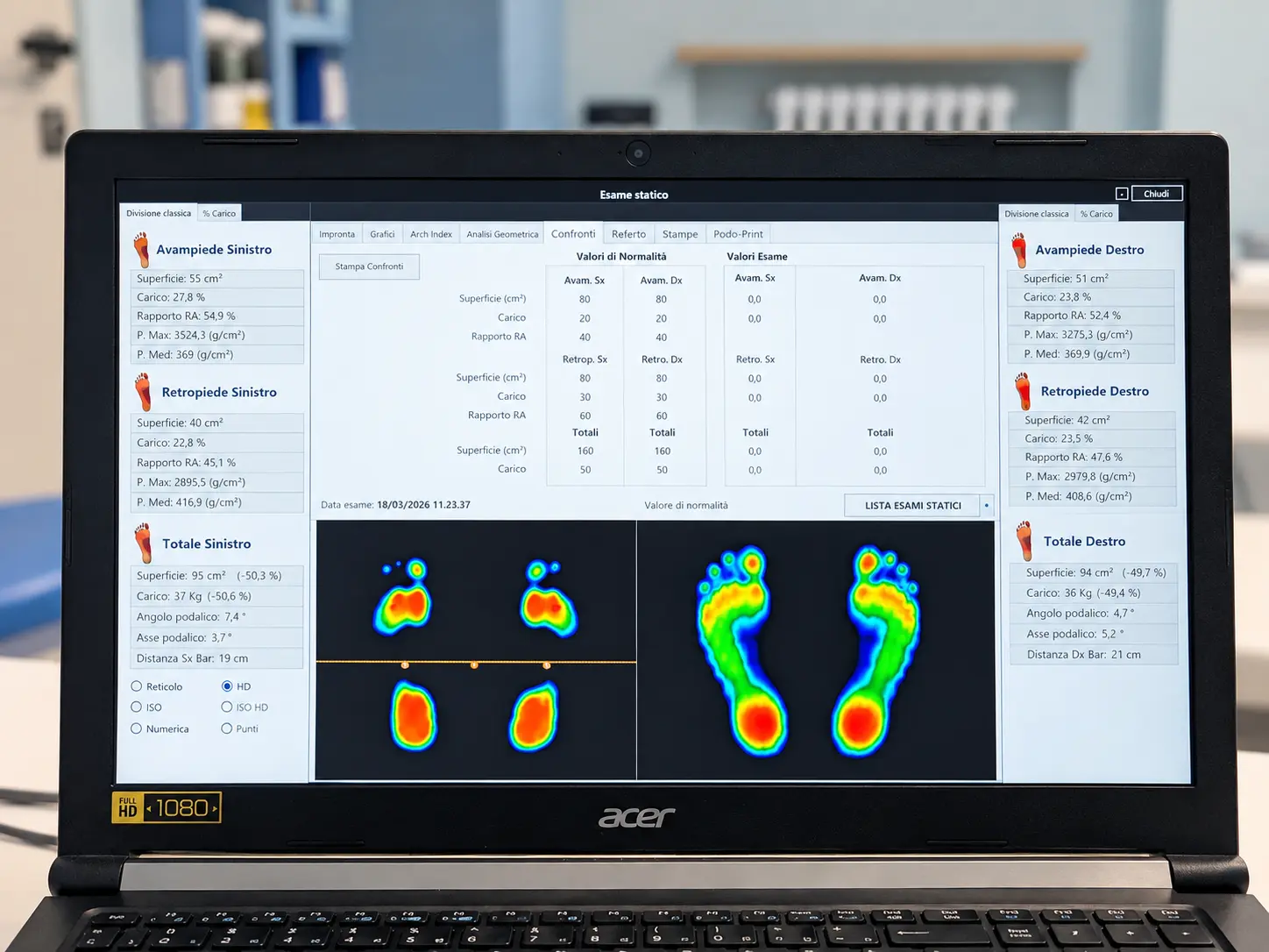 Analisi podologica su laptop Acer