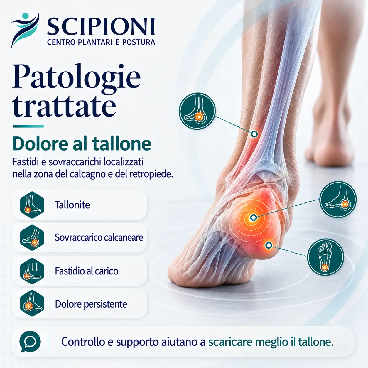 patologia-dolore-tallone