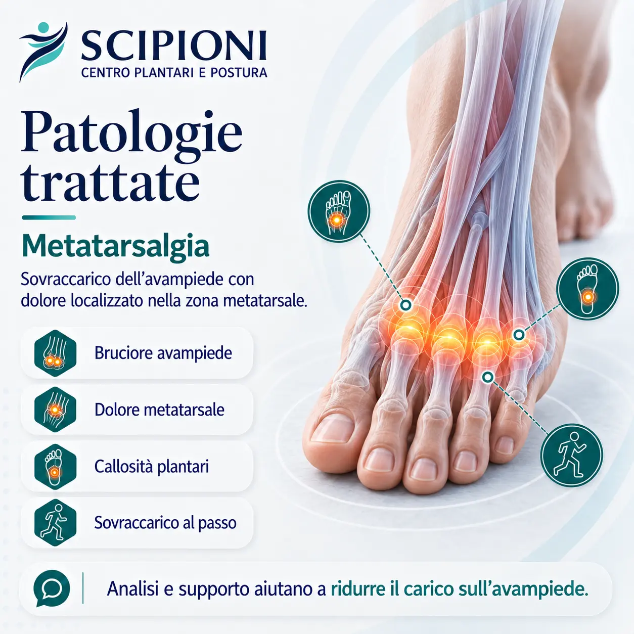 patologia-metatarsalgia