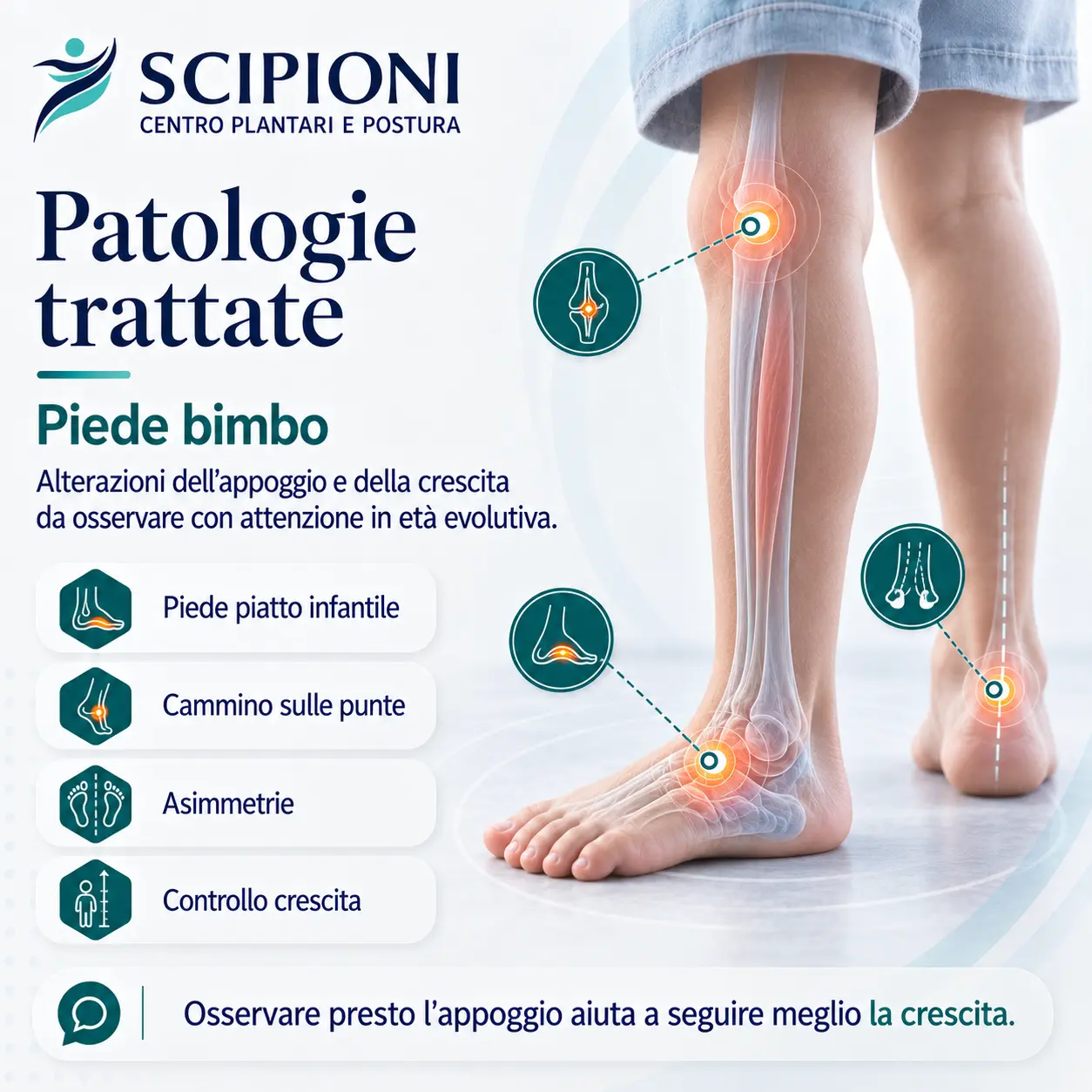 patologia-piede-bimbo