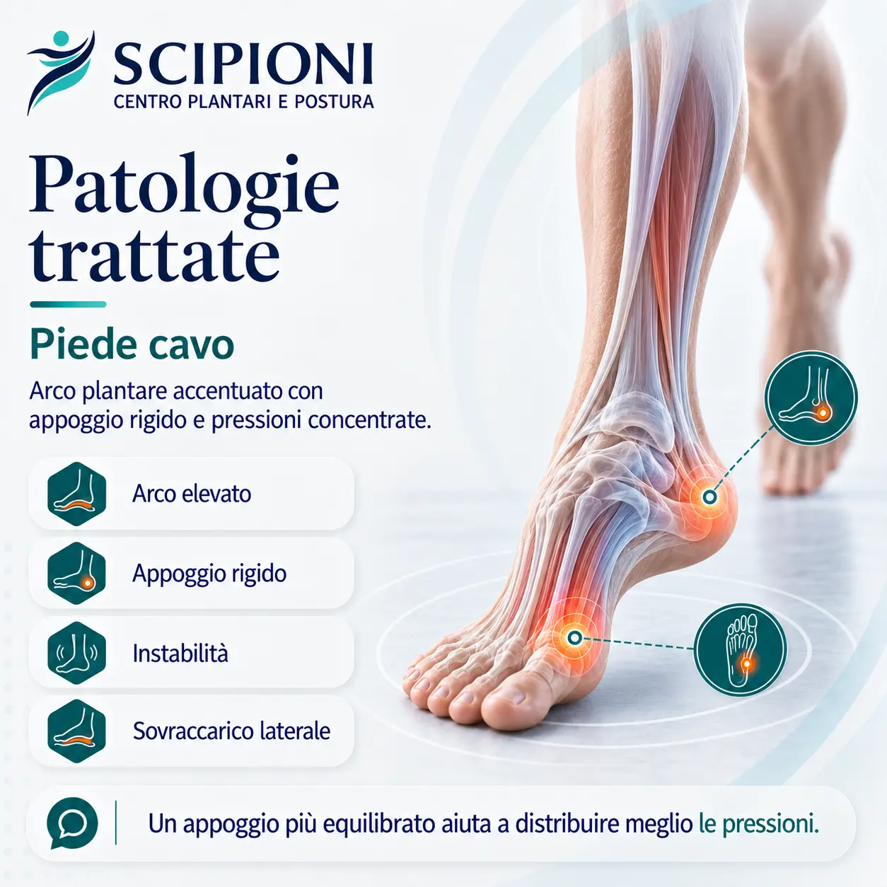 patologia-piede-cavo