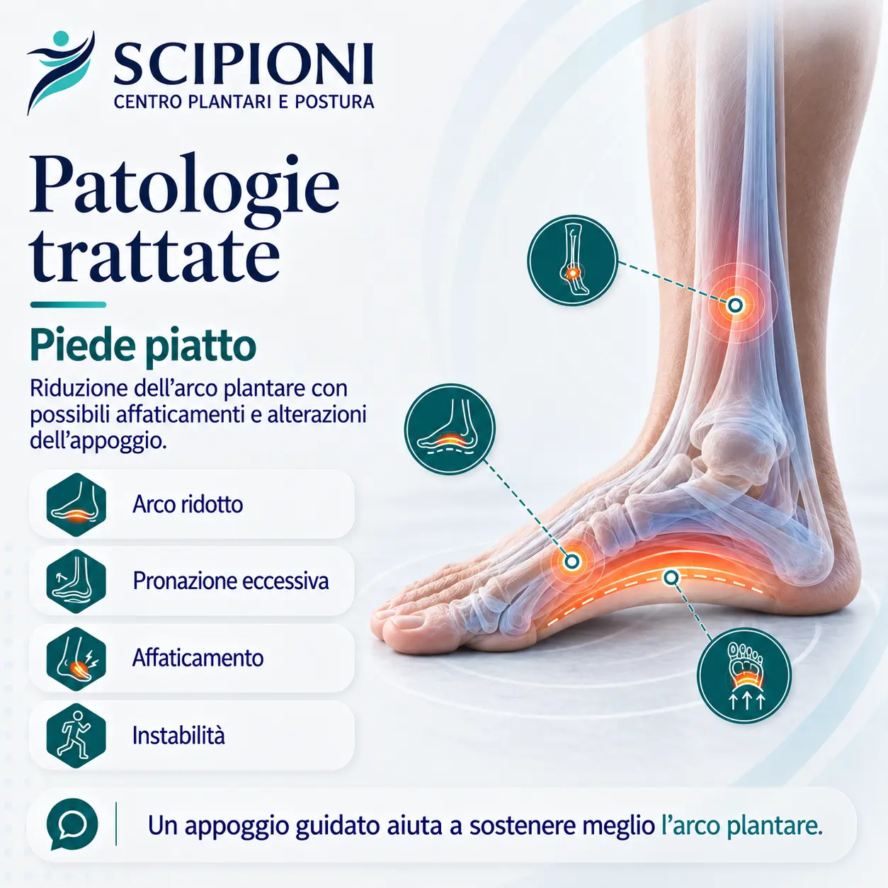 patologia-piede-piatto